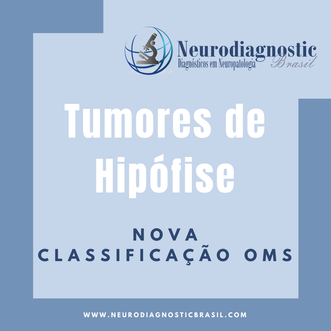 Tumores de Hipofise 2