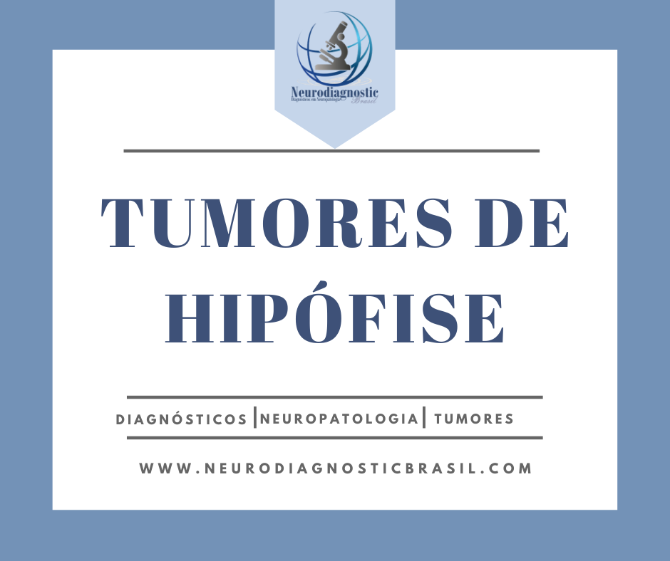 Tumores de Hipófise - parte 1